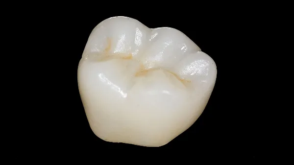 Een_kroon_buiten_de_mond.webp