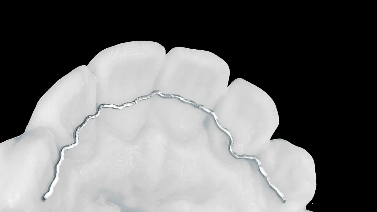 Draad_retainer_vast.webp