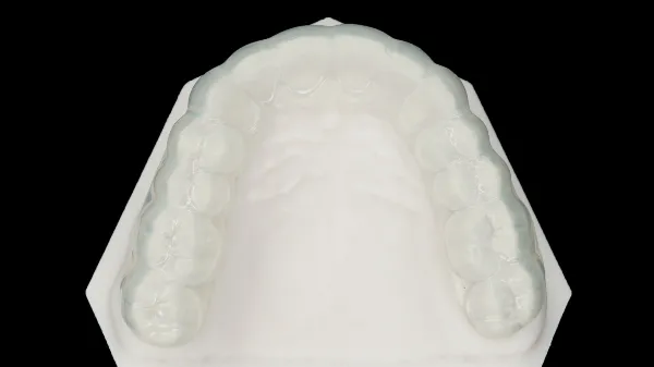 Drumschiene_op_model.webp