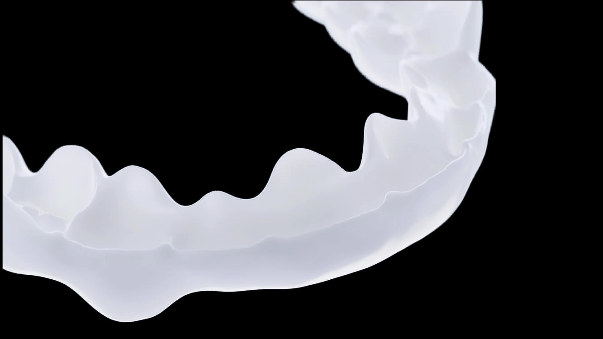 Whitesplint.webp
