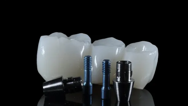 Implantaten_1.webp