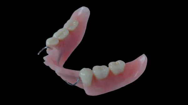 Partiele_prothese.webp